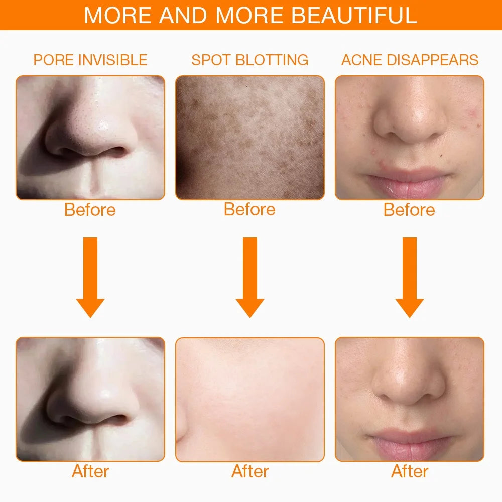 7-Colors Anti-Aging LED Face Neck Beauty Skin Care